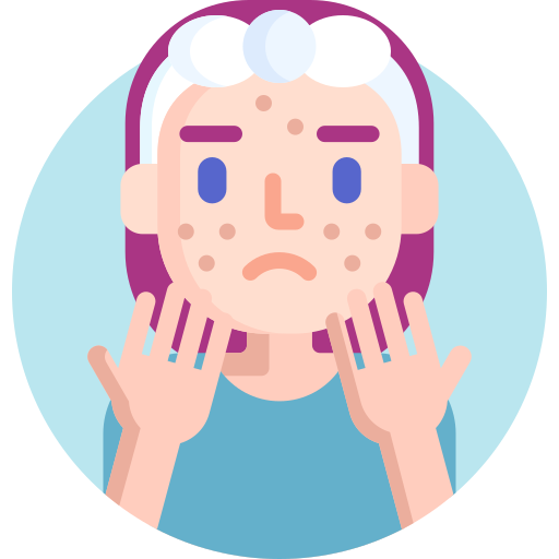 pimples